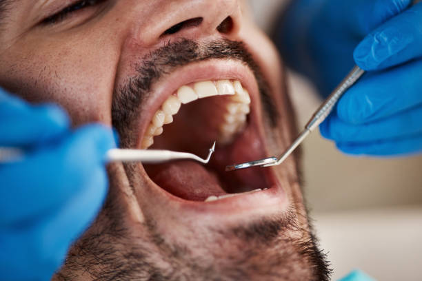 Best Broken Tooth Emergency  in Bensenvle, IL